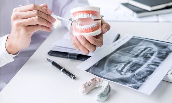 Cần chú ý khi đau răng nên uống thuốc gì đúng loại, đúng bệnh