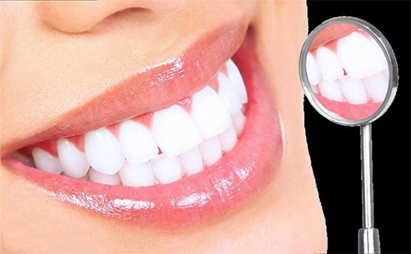 Đối tượng nên thực hiện tẩy trắng răng