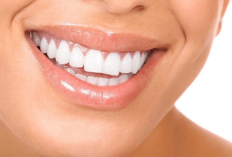 Các phương pháp tẩy trắng răng
