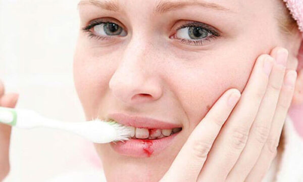Nướu bị tổn thương sẽ gây ra ngứa chân răng