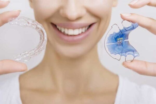 Có 2 lý do phổ biến dẫn đến tình trạng răng dịch chuyển