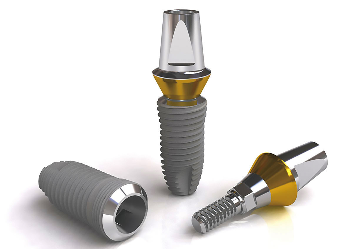 Ưu điểm của implant Hàn Quốc