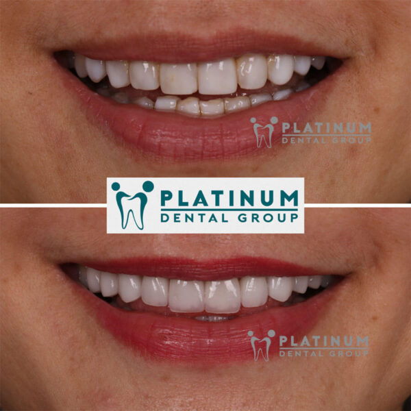 Dental clinic vietnam prices