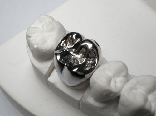 Metal porcelain crown
