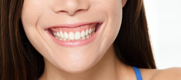 How to do gummy treatment?