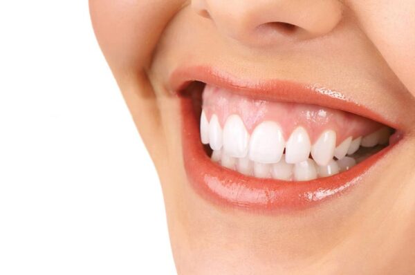 Treatments may grow more intrusive and necessitate surgery when the cause of a gummy smile is a moderate to severe jaw protrusion