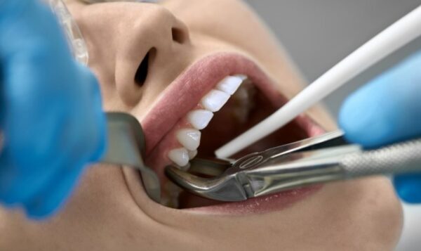 Who is suitable for the immediate implant after extraction?