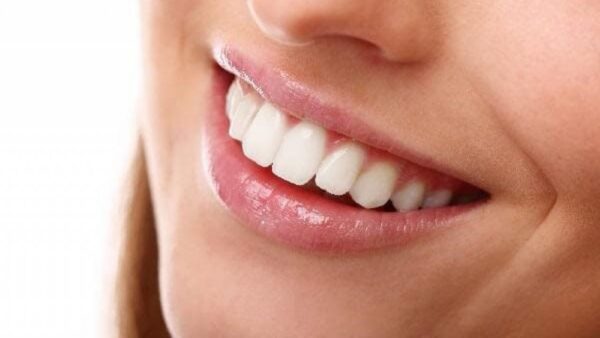 Làm răng thỏ bằng phương pháp trồng implant