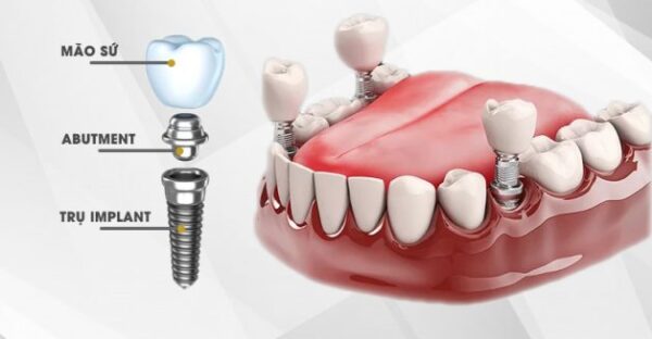 Dental Consultation