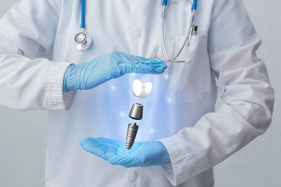 Implant placement steps