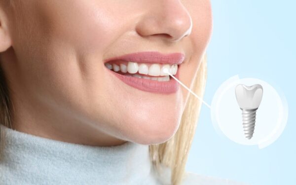 Safety considerations in dental implant procedures