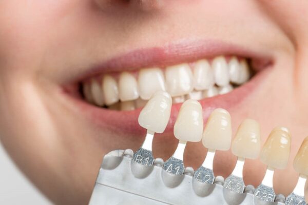 Is removing a tooth implant painful? Is removing a tooth implant painful?