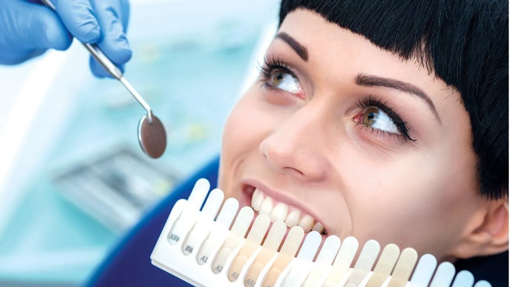 Who should get their teeth whitened?