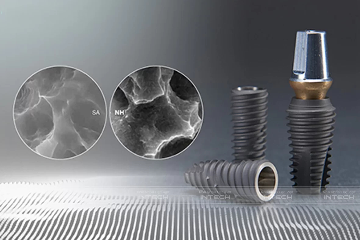 Đôi nét về Implant hiossen