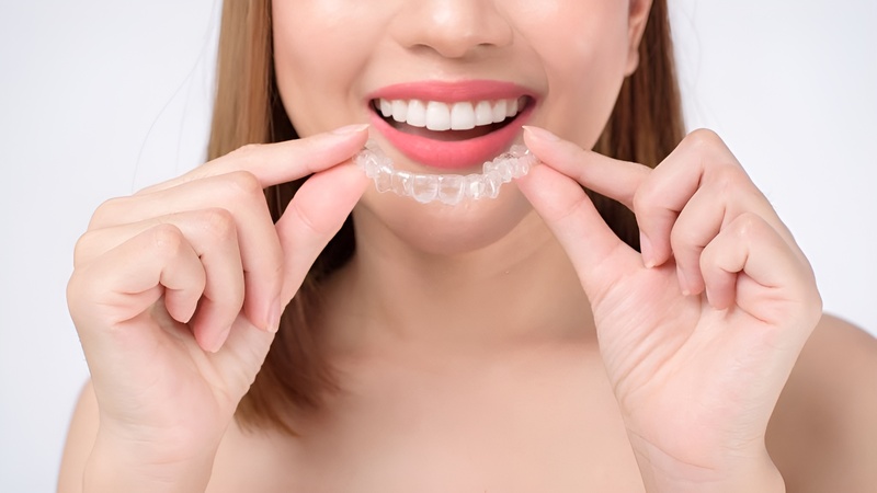 Nên chọn niềng răng zenyum và invisalign