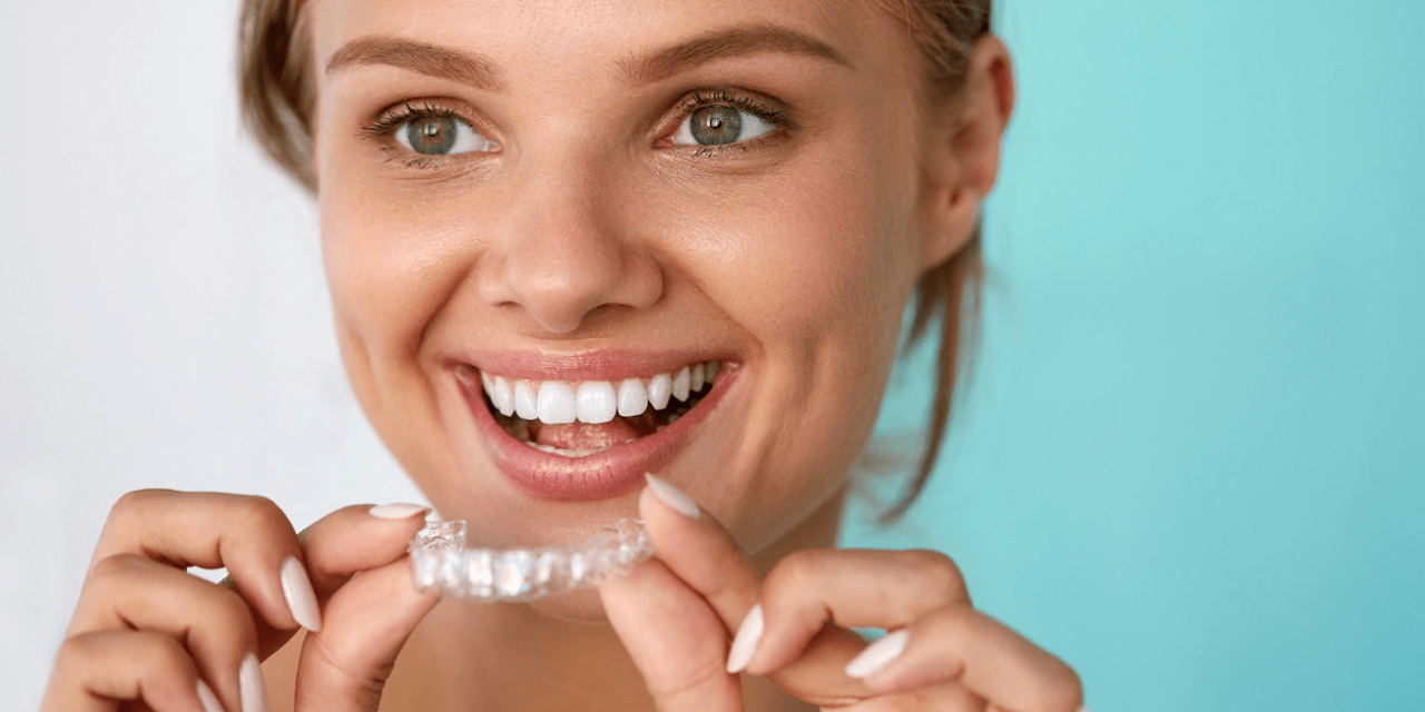 Tìm Hiểu Về Các Loại Niềng Răng Trong Suốt Phổ Biến Và Tốt Nhất Hiện Nay