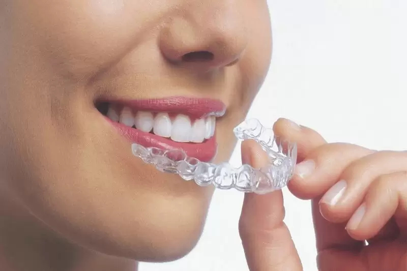 Ưu và nhược điểm của niềng răng zenyum và invisalign