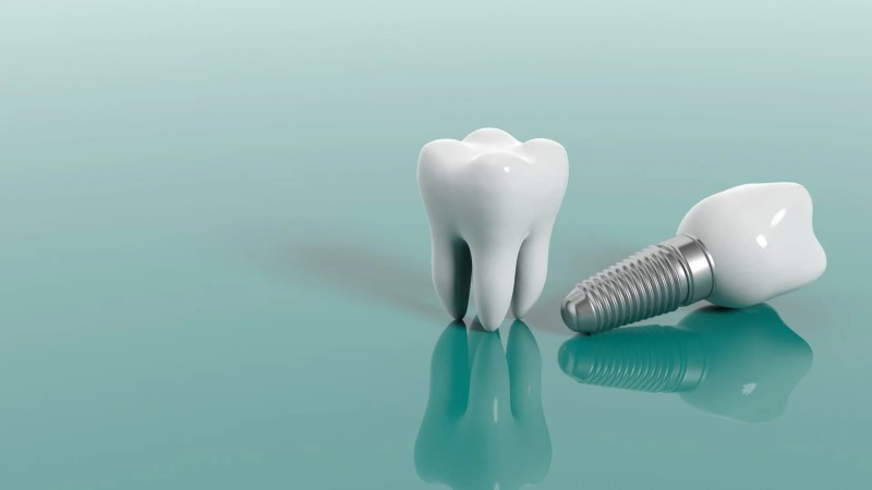 How to stop dental implant bleeding after surgery?