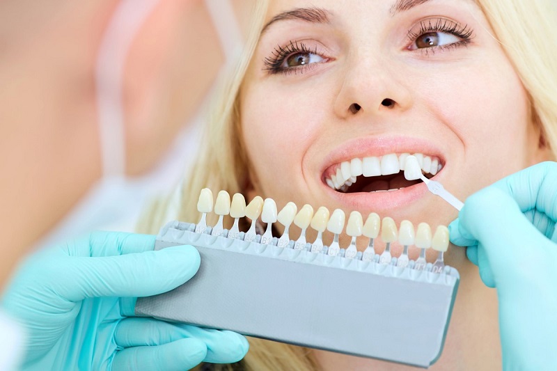 The importance of white teeth