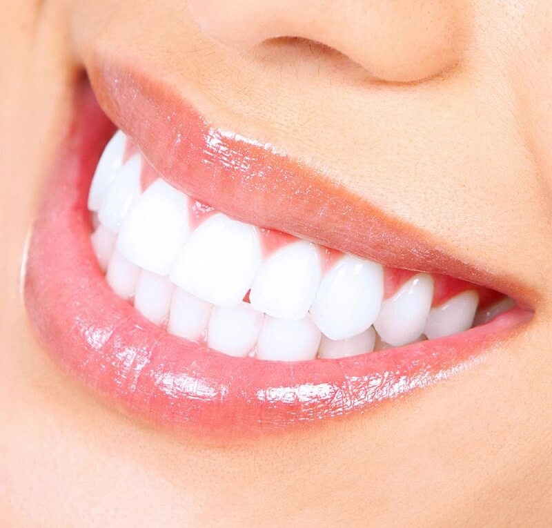 Notes when whitening teeth