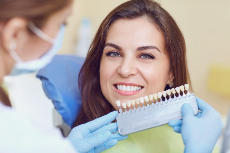 How long does teeth whitening last? How to take care of teeth after whitening?
