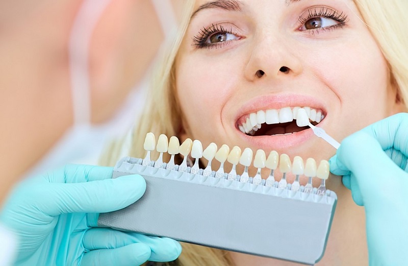 Be careful when whitening your teeth at home