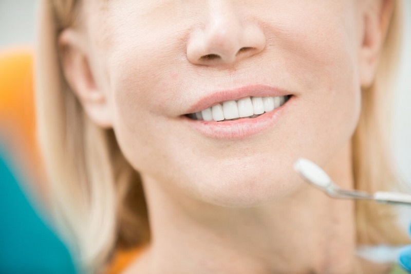 Choose to change the appearance of your teeth