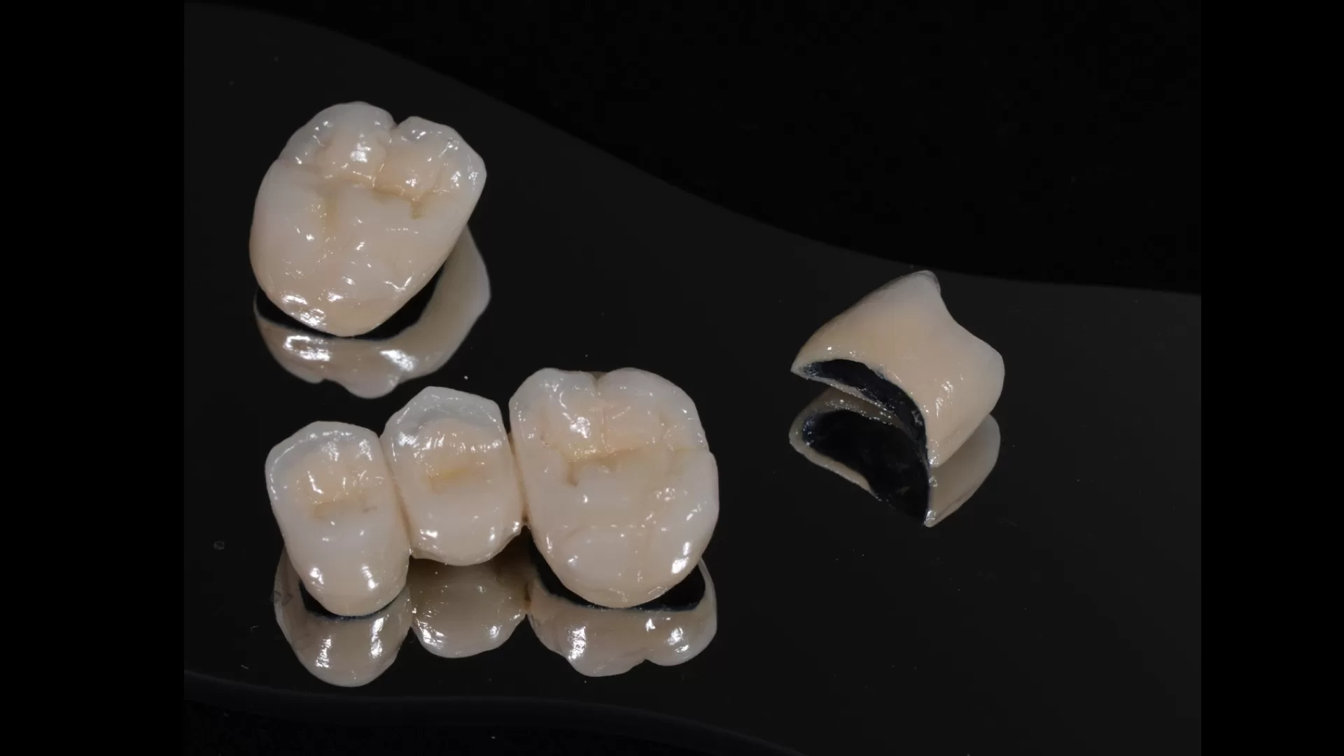 Trồng răng sứ Titan giá bao nhiêu là hợp lý và chuẩn nhất?