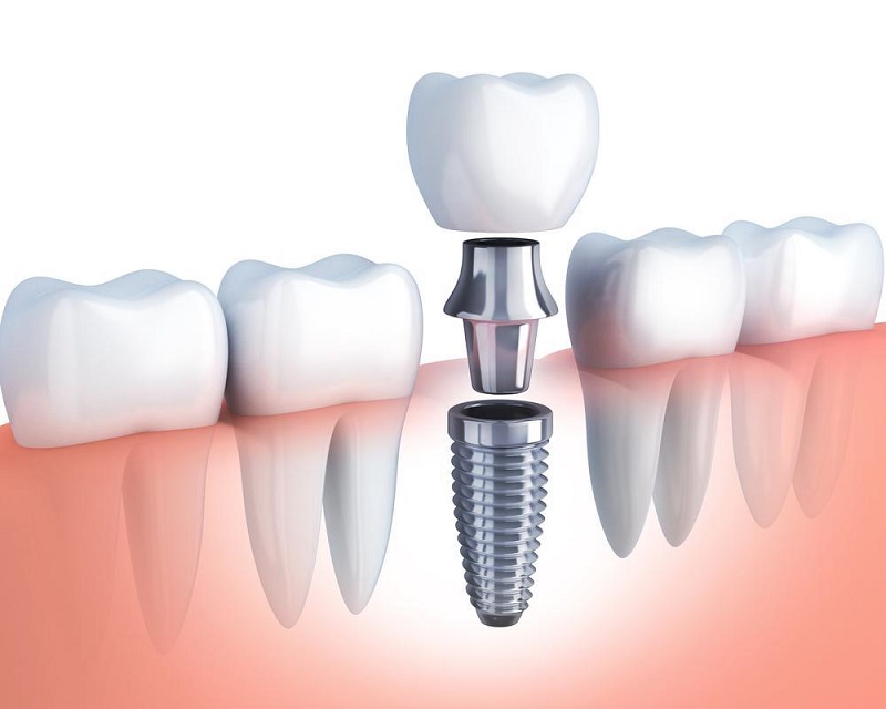 Bleeding and pain after a tooth extraction
