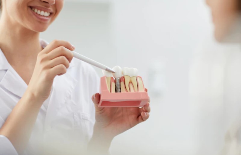 Reasons why your dental implant feels loose