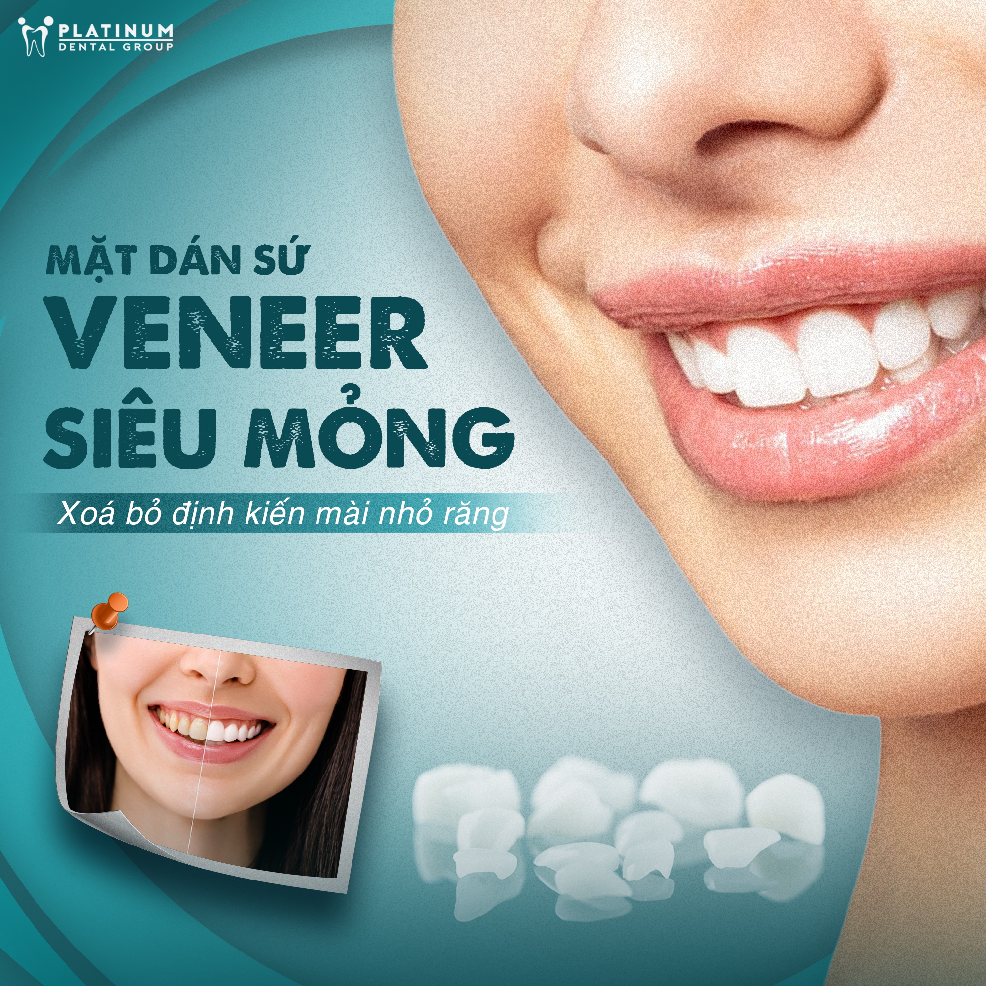 Đòi hỏi tay nghề cao