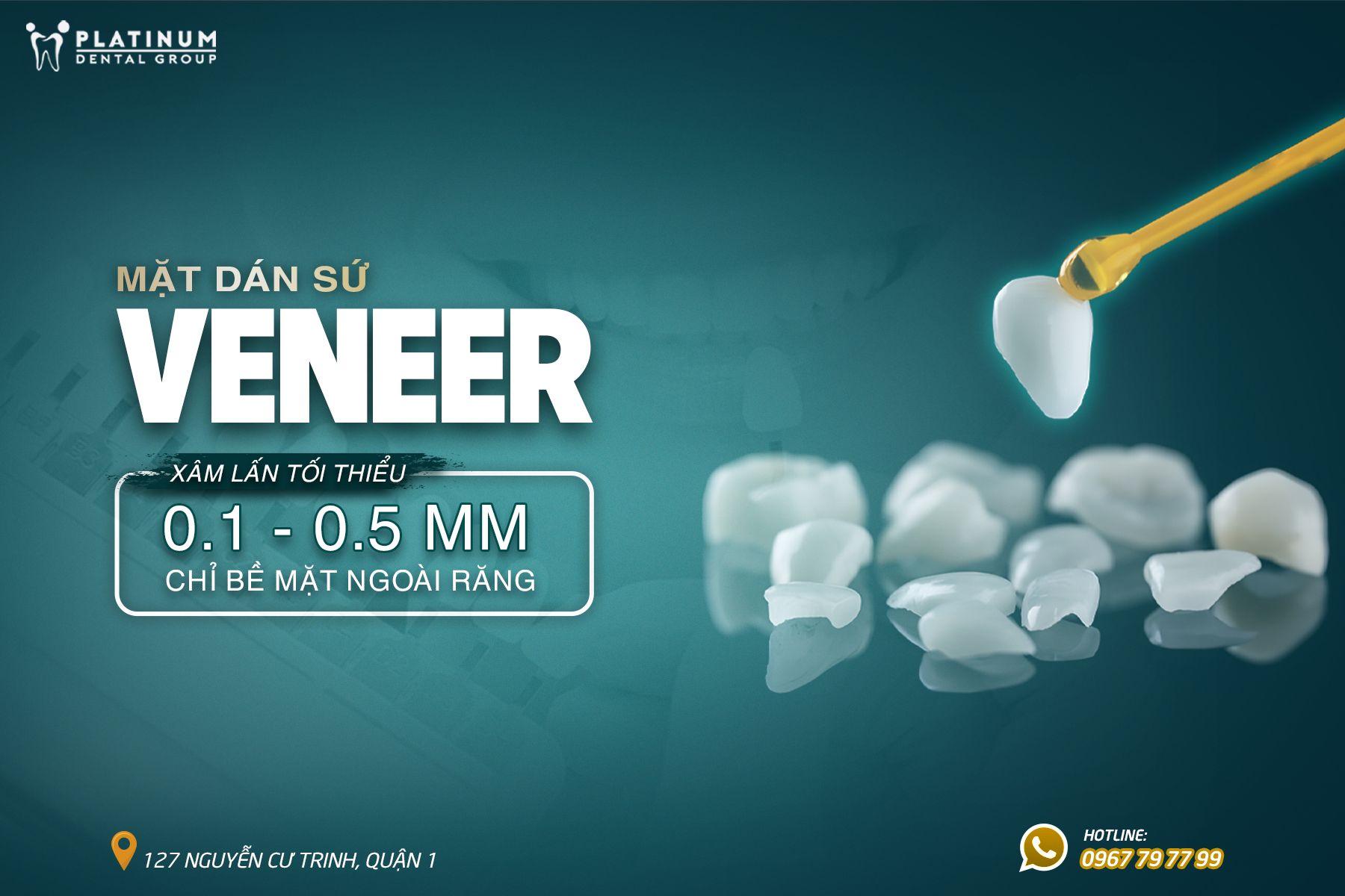 Dũa răng và gắn Veneer tạm