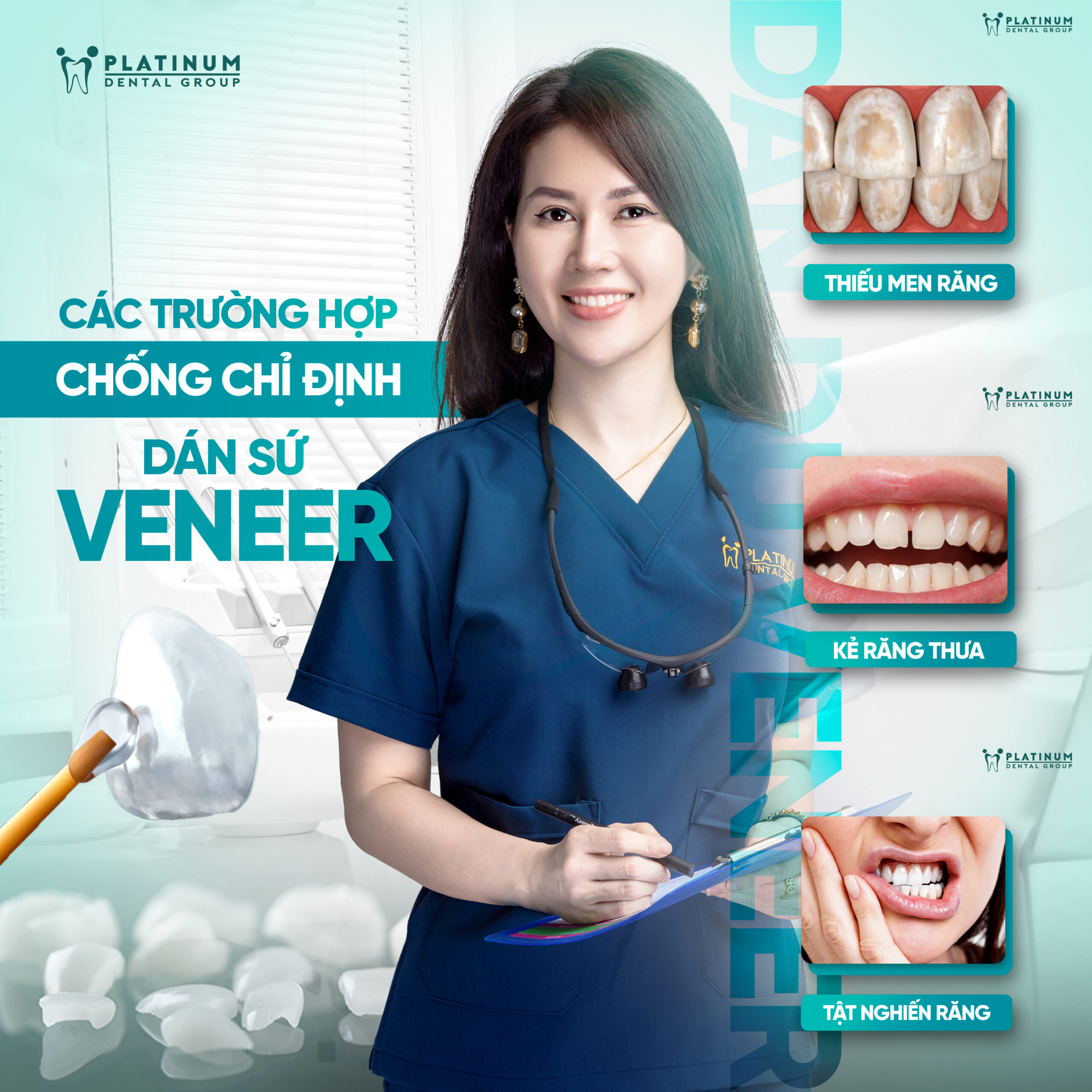 Chọn dán sứ Veneer? Chọn Platinum Dental!