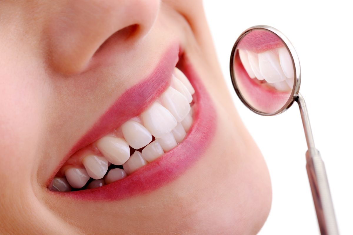Các loại răng sứ phổ biến