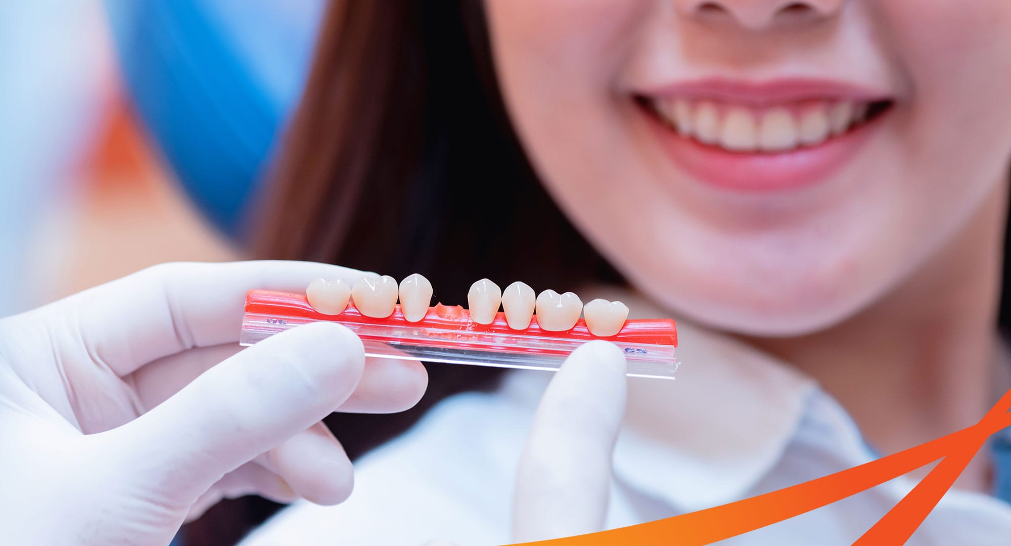 Ưu và nhược điểm khi tiến hành cầu răng sứ