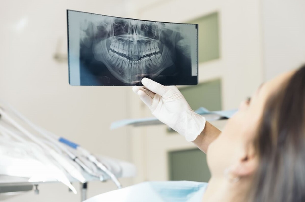 Răng sứ bị hở phải làm sao?