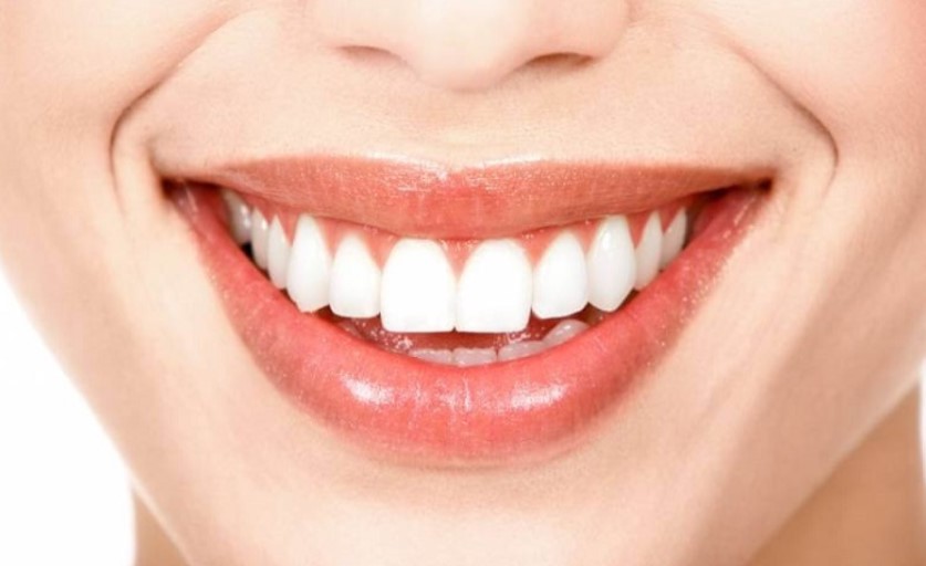 Form răng thỏ là một trong những form răng sứ đẹp nhất hiện nay