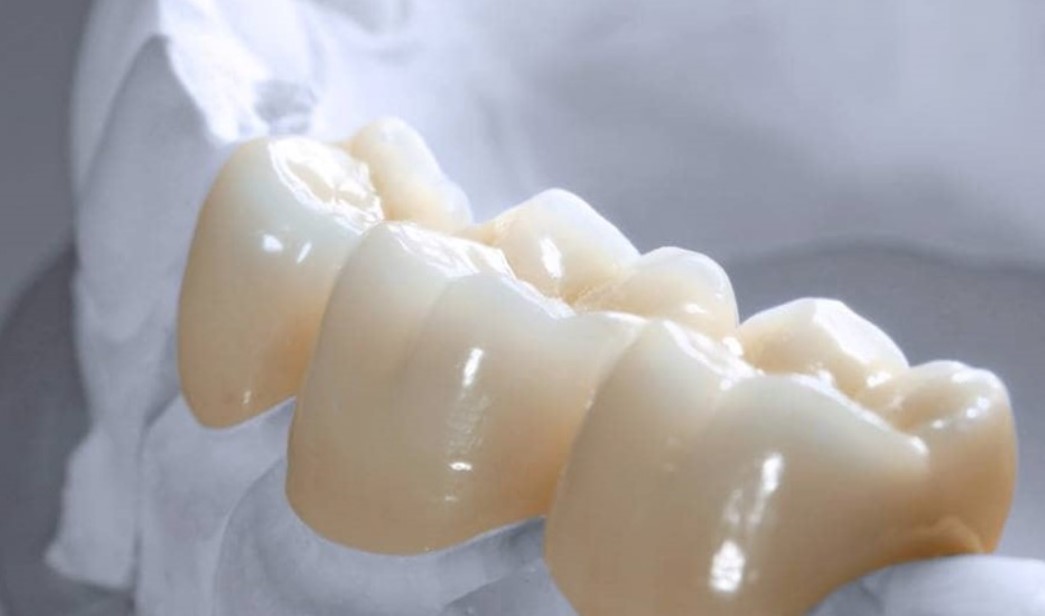 Răng sứ Cercon Zirconia