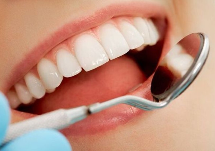 Khi nào nên bọc răng sứ Cercon?