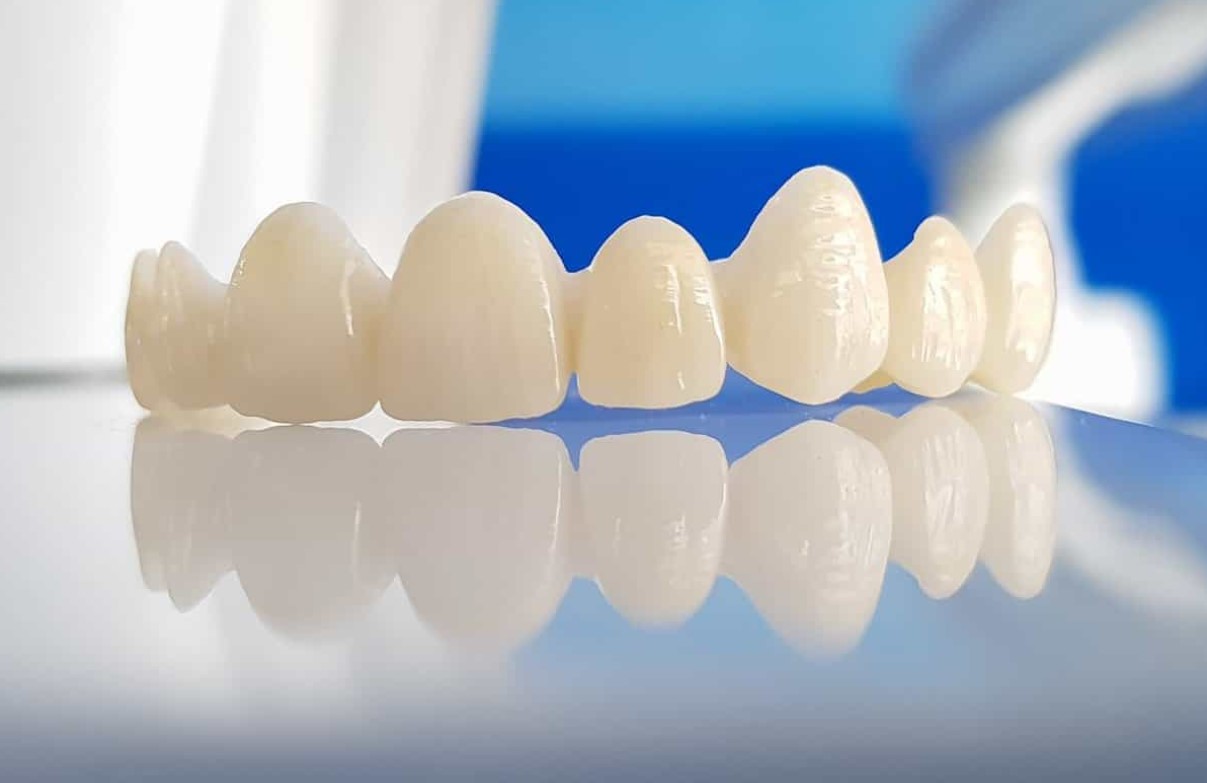 Răng sứ DDBio có tốt không?
