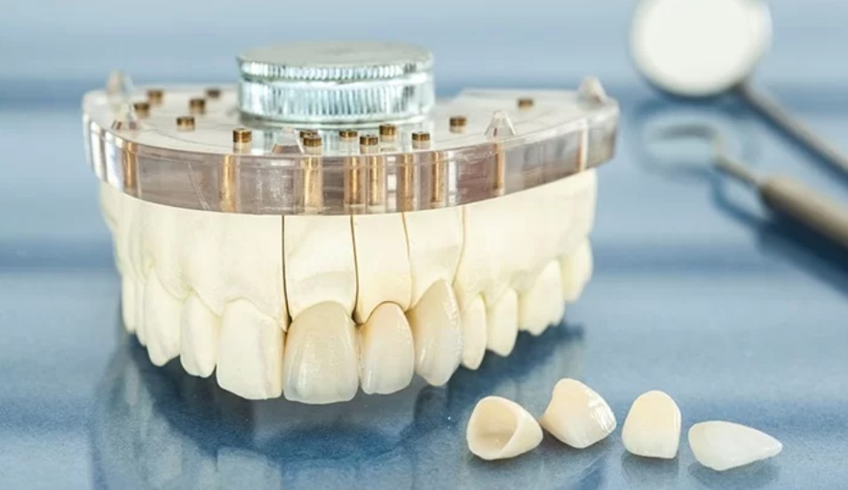 Cách phân biệt răng sứ Đức thật giả