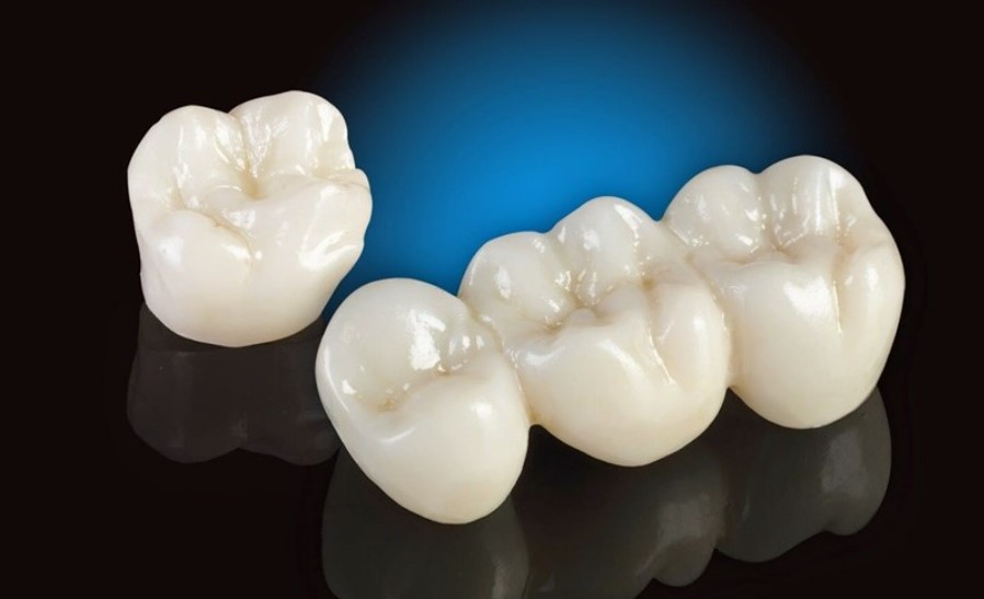 Răng toàn sứ Emax ZirCAD