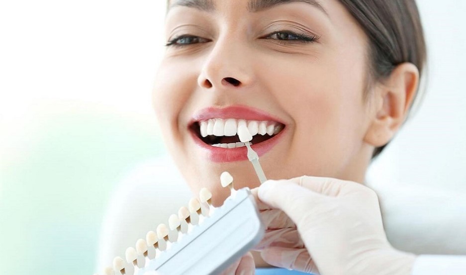 So sánh sứ Emax và Cercon