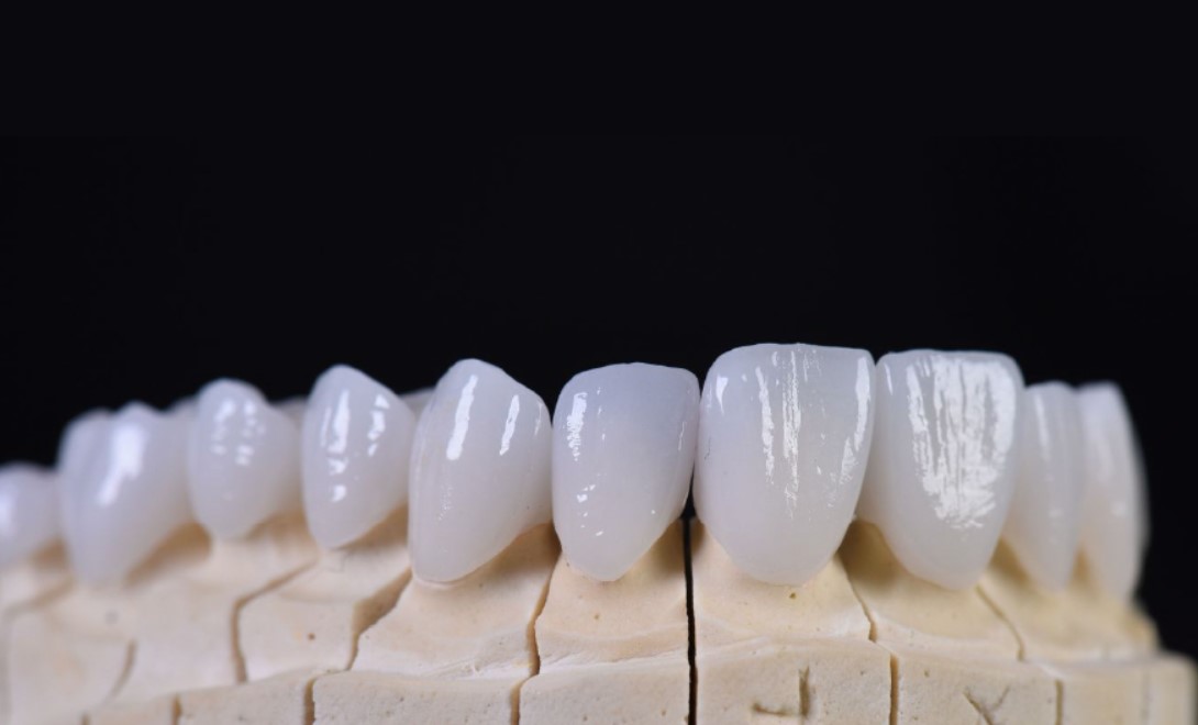 Răng sứ HT Smile