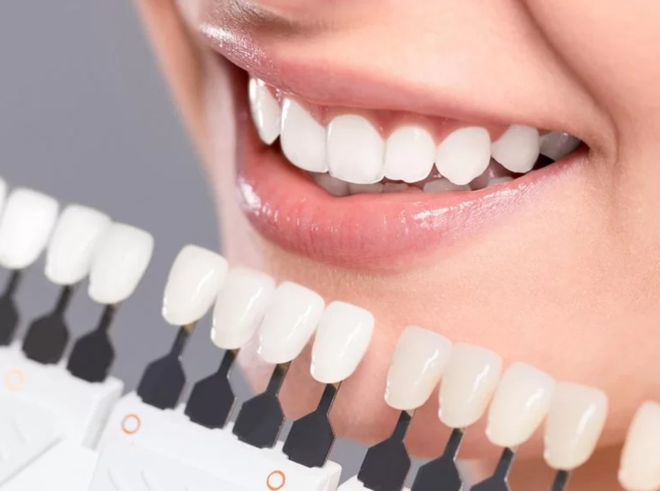 Răng sứ HT Smile có tốt không?