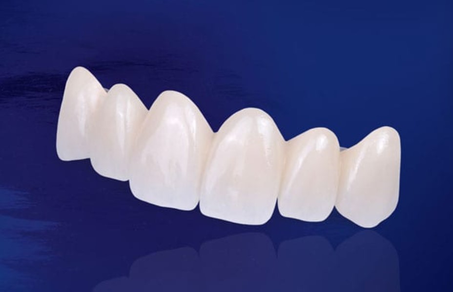 Răng sứ không kim loại Zirconia