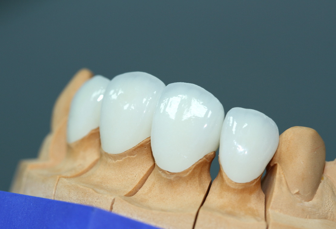Được chế tác từ sứ nguyên chất 100%