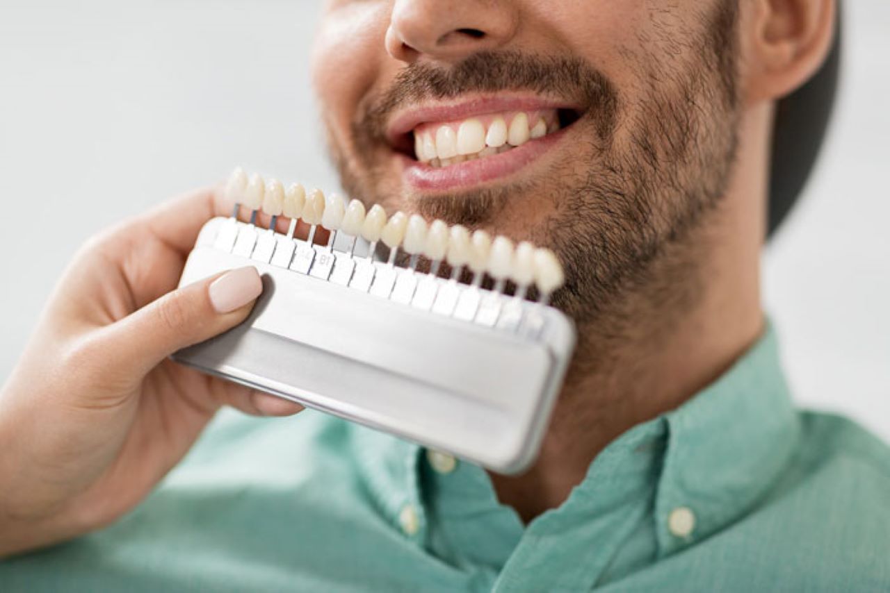 Khả năng chịu lực gấp 5 lần răng thật