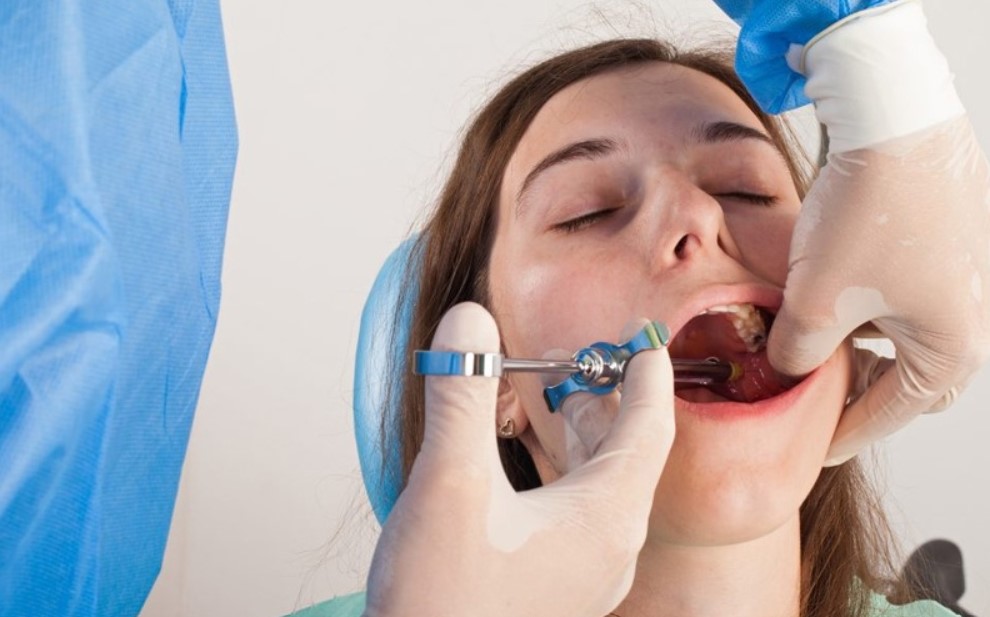 Quy trình bọc răng sứ lần 2 tại Platinum Dental