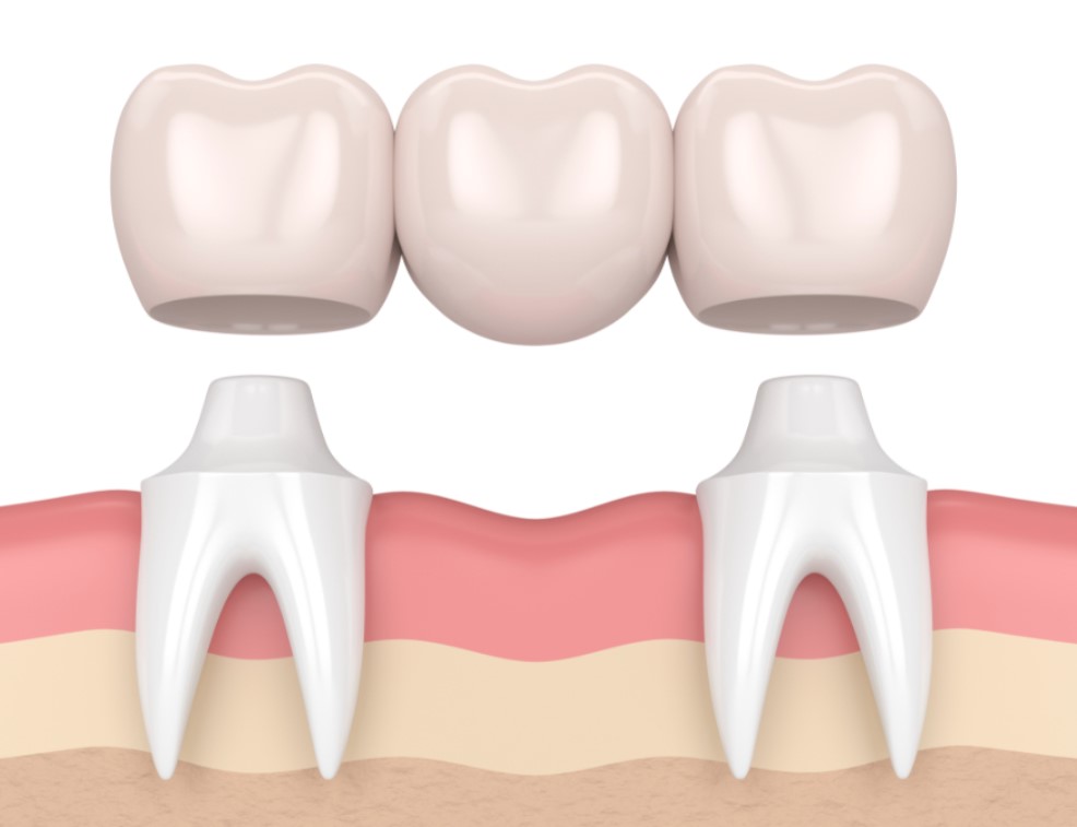 Hạn chế đối tượng sử dụng